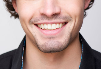 Dents unitaires sur implants.
